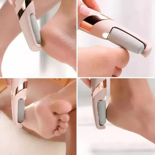 DermaSmooth™ – Tecnología avanzada para eliminar durezas con suavidad.